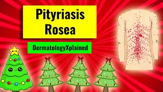 Pityriasis rosea christmastree rash clinical features associations histology and management [upl. by Notniuqal]