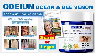 ODEIUN Ocean amp Bee Venom Psoriasis Healing Cream Review [upl. by Aliuqat660]