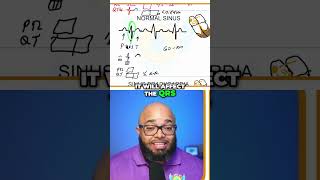 Understanding Hyperkalemia EKG Changes You Must Know [upl. by Llehcnom418]