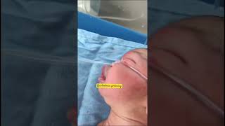 Opisthotonos posture in newborn  care of newborn baby  newborn born baby  youtubeshorts [upl. by Yllim]