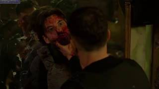 Marvels The Punisher Season 1  Billy Russo becomes The JigSaw [upl. by Ennael]