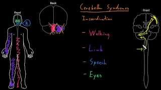 Syndrome Cerebellar syndromes [upl. by Crin]