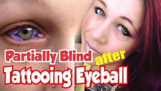 5 Things About Catt Gallinger Partially Blind After Tattooing of the Eyeball [upl. by Ced]