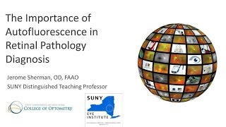 The Importance of Autofluorescence in Retinal Pathology Diagnosis [upl. by Aix]