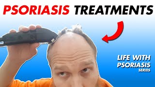 5 Psoriasis Treatments Bonus  Watch Till The End  Life With Psoriasis [upl. by Korwun]