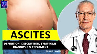 ASCITES Definition Description Causes and symptoms Diagnosis amp Treatment of Ascites [upl. by Sirromed564]