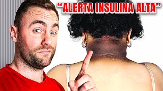 🚨5 Avisos de Resistencia a la Insulina en tu Cuerpo Sin Análisis de Sangre [upl. by Alhahs]