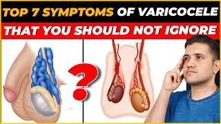 Top 7 Symptoms of Varicocele You Shouldn’t Ignore  Best Treatment Explained by Dr Gaurav Gangwani [upl. by Breech]