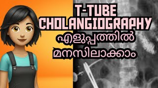 TTUBE CHOLANGIOGRAPHY Complete study explained in Malayalam [upl. by Joly]