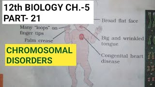 Class 12 biology chapter 5part 21chromosomal disordersby study with Farru [upl. by Lodie]