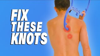 How to Release Knots Between Shoulder Blades NO MASSAGE SOLUTIONS [upl. by Fotina]