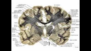 Neuropathology101Basic Neurohistology and NonNeoplastic lesionsmov [upl. by Reinnej931]