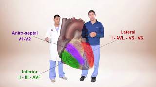 INFARCTION Causes Types Morphology [upl. by Asila]