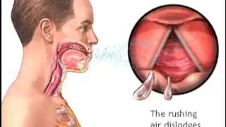 How Do We Cough  The Mechanism of Coughing  Cough Reflex Animation  Learn Human Body [upl. by Monteith377]