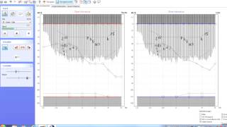 Perzentilanalyse mit FreeFit Anpassbeispiel [upl. by Anaela]