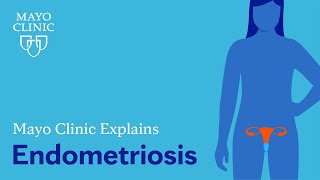 Mayo Clinic Explains Endometriosis [upl. by Ailegra]