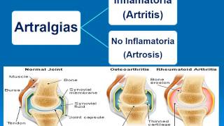 Semiologia Osteoarticular Dr Angel Granado [upl. by Adekam]