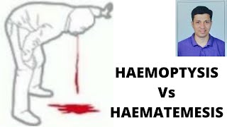 HAEMOPTYSIS vs HAEMATEMESIS [upl. by Noreh]