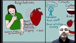 Palpitations vs Arrhythmias What is the most common cause of palpitations [upl. by Lytsyrk]