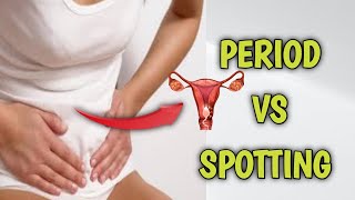 Spotting vs period blood understanding the difference [upl. by Ray]