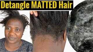 How To Detangle Crazy Knotted Hair In 4 HRS After 9 months  With Viral Product 20M Views On TIKTOK [upl. by Joanie710]