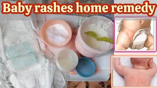 baby rashes  baby rash home remedy [upl. by Aissatsan]