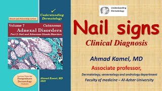 Nail signs Clinical Diagnosis of Skin Diseases [upl. by Cianca156]