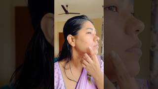 Pimple free skin💔❤️‍🩹 Acne prone Skin story🙄 [upl. by Gavra]