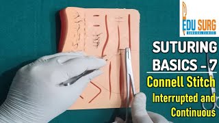 Intestinal anastomosis l Connell Stitch l OSCE skill stations part 7 l Surgical clinics [upl. by Dagmar]