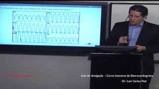 CURSO DE ELETROCARDIOGRAMA  AULA GRÁTIS ECG [upl. by Laamak]