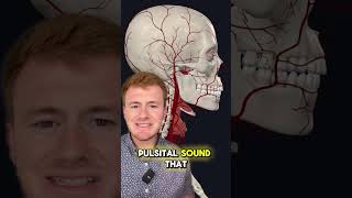 Pulsatile Tinnitus Doctor Sarasota Lavender Family Chiropractic resolves whooshing sounds in ear [upl. by Anibla]