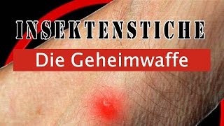 Insektenstiche behandeln  die GEHEIMWAFFE [upl. by Proctor]