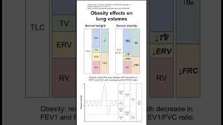 Obesity effects on lung volumes [upl. by Franchot]