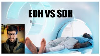 EDH vs SDH Basics of Epidural hematoma amp Subdural hematoma NEETPG INICET MBBS MD RADIOLOGY [upl. by Mayhs]