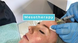 Mesotherapy With Anna [upl. by Kenric405]