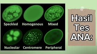 ANA Antinuclear Antibody Test [upl. by Ayad903]