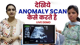 Anomaly scan in pregnancy Dr Asha Gavade [upl. by Nivrad]