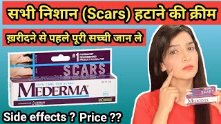 Mederma cream  mederma for acne scars  mederma advanced scar gel review [upl. by Enelrae]