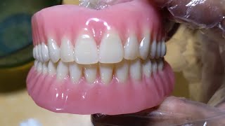 Upper Full Flexible Denture and Lower partial Denture [upl. by Nirat901]