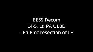 BESS decompression L45 Lt IPA  En Bloc resection of ligamentum flavum [upl. by Nnaarat]