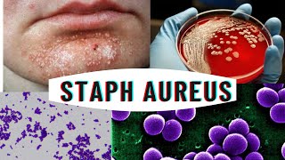 Staphylococcus aureus  staphylococcus infection  causes symptoms [upl. by Nolie]