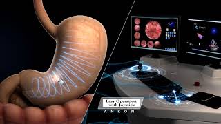 Capsule Endoscopy Animation  ANKON NaviCam [upl. by Zaid]