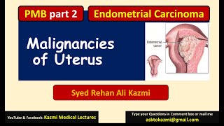 Part 2  PMB  Endometrial hyperplasia  Carcinoma  Sarcoma  Gynecology Review  KML [upl. by Ytsur]