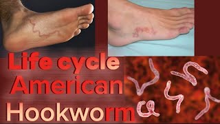 Life Cycle of American Hookworm  Necator Americanus  Phylum Nematoda  English [upl. by Lenhard]