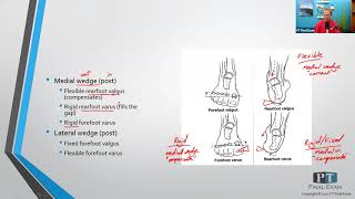 Forefoot and Rearfoot Deformities [upl. by Rickard]