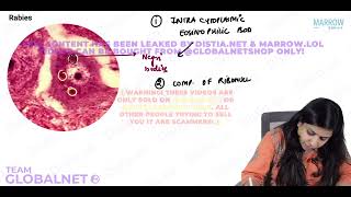 CNS  NON NEOPLASTIC LESIONS By Dr Illa jain khandelwal Pathology by Marrow Video Lecture [upl. by Adrahs]