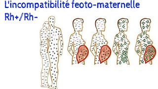 lincompatibilité rhésus Fœto maternelle [upl. by Theis464]