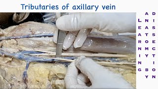 Dissection of axilla and tributaries of axillary vein  Dissection of upper limb  Dr SAM [upl. by Akeimat]