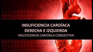 Insuficiencia cardíaca derecha e izquierda [upl. by Shakespeare2]