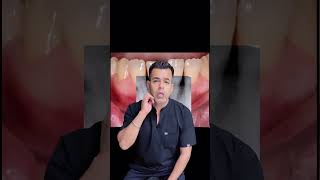 5 signs of severe pulp infections  Discovering the dangers of pulp infections delhidentist [upl. by Diskson]